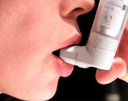 Microbiome and Asthma Microbiome and Asthma