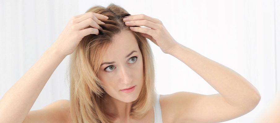 Menopause Hair Loss
