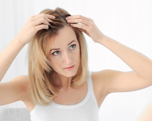 Hair loss in Menopause