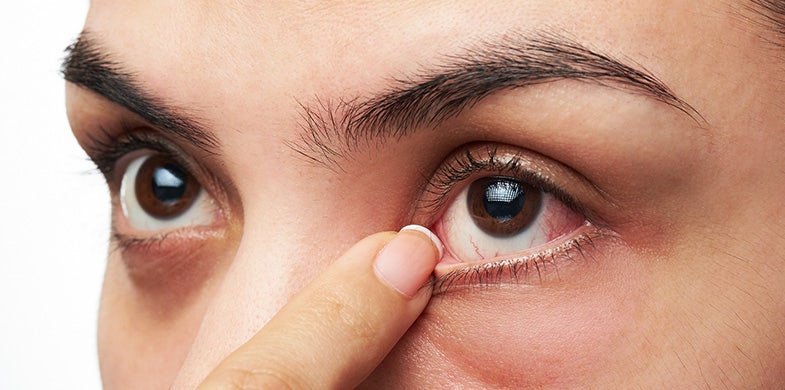 See What Causes and Relieves Dry Eyes